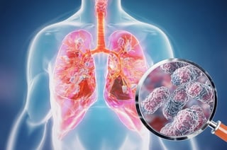 Legionnaires’ Disease: The 1976 Outbreak 50 Years On