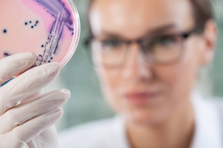 Microbiologist holding a Petri dish with bacteria, horizontal- lower res