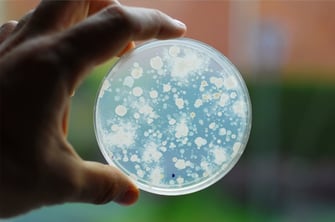 Legionella and TVCs
