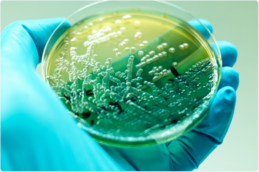 Pseudomonas aeruginosa positive results